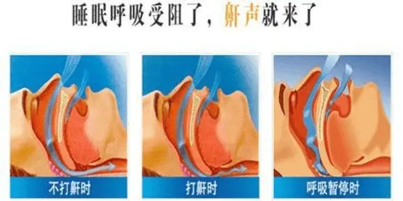 家用呼吸机哪个品牌最好_家用呼吸机哪个牌子_家用呼吸机哪种好