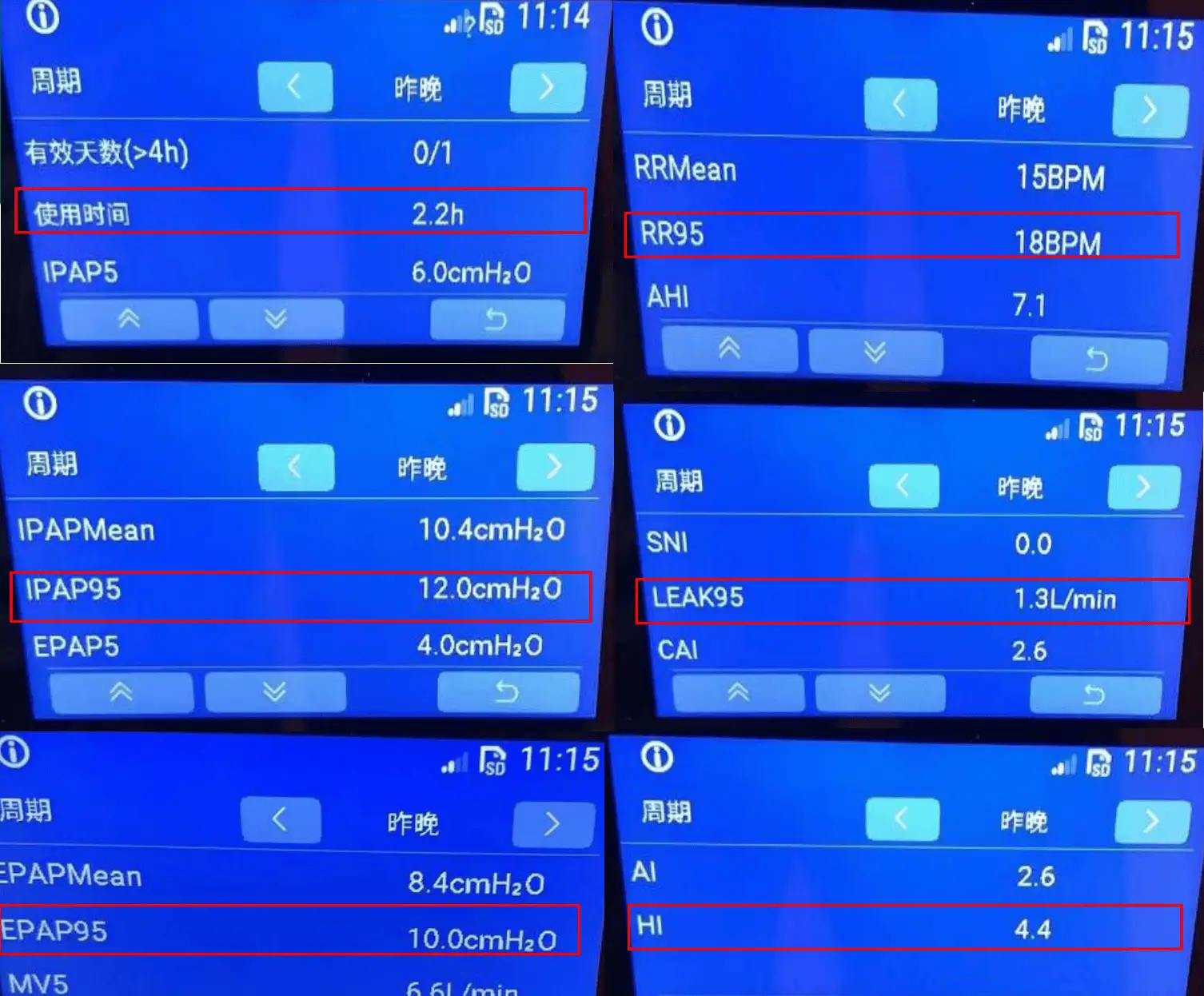 家用呼吸机哪个品牌最好_家用呼吸机哪个牌子_家用呼吸机哪种好