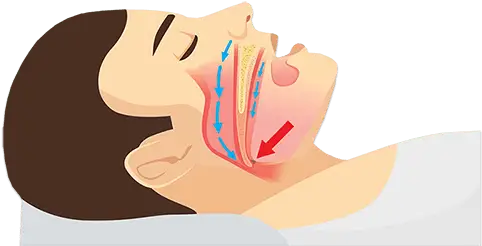 家用呼吸机哪个品牌最好_家用呼吸机哪种好_家用呼吸机哪个牌子