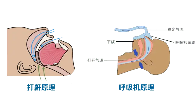 家用呼吸机哪个牌子_家用呼吸机哪个品牌最好_家用呼吸机哪种好