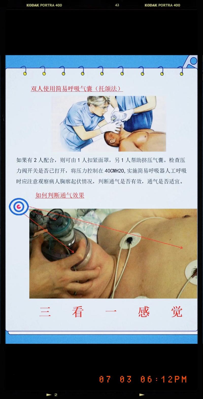 便携式呼吸仪_便携式呼吸器使用方法_便携式呼吸器的作用